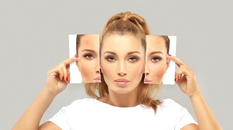 Embracing Your Beauty Spot - Transforming Self-Doubt into Confidence at Work